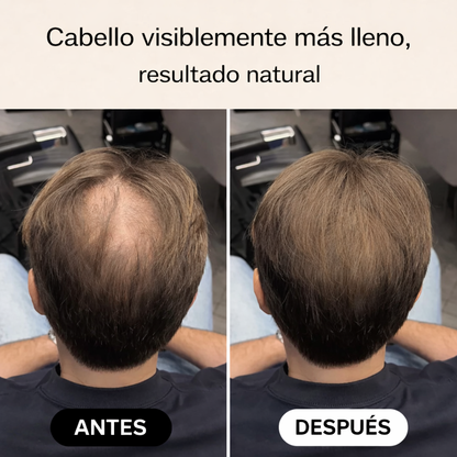 KIMÉ™ | Control Capilar DENSIFICADOR