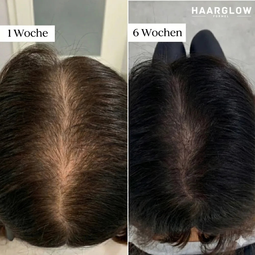 KIMÉ Glow™ – Sistema de Micro-Infusión Capilar